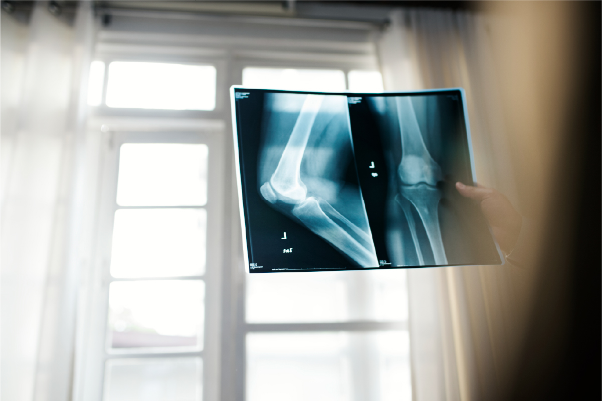 Complex Trauma Orthopeadic Surgeon Stellenbosch