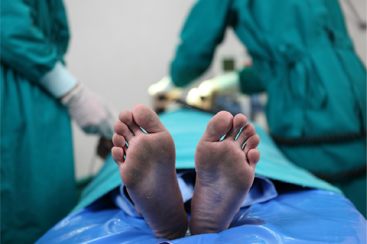 Foot Ankle Surgery Dr Franz Birkholtz Orthopeadic Surgeon Stellenbosch
