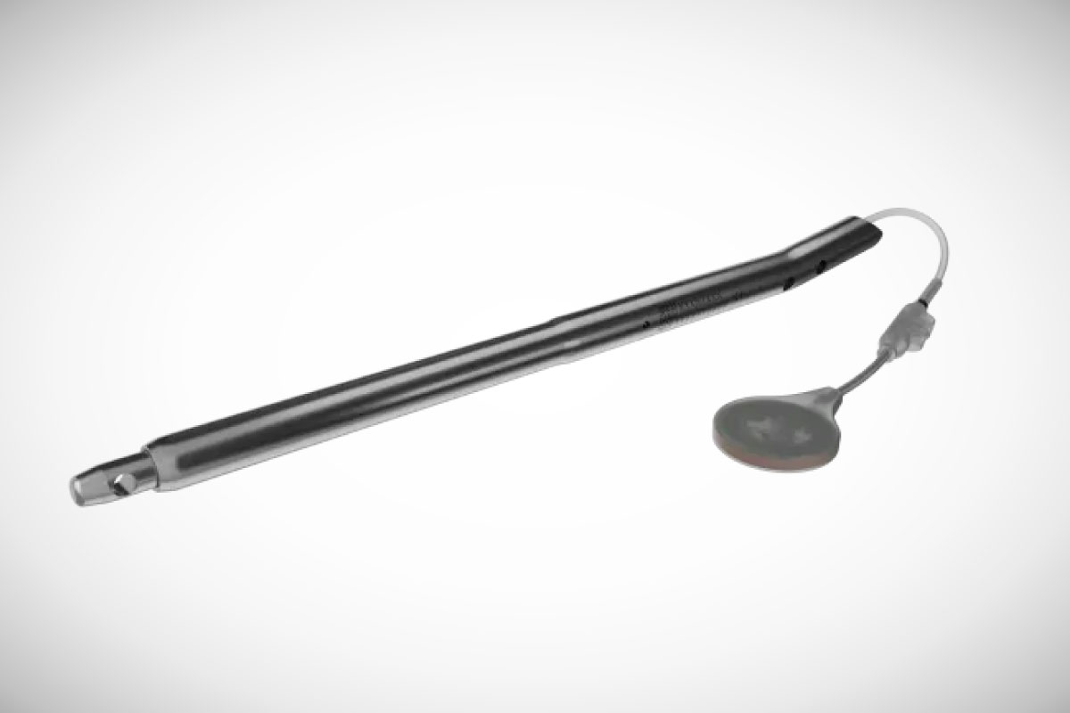 Limb Lengthening Dr Franz Birkholtz Orthopeadic Surgeon Stellenbosch